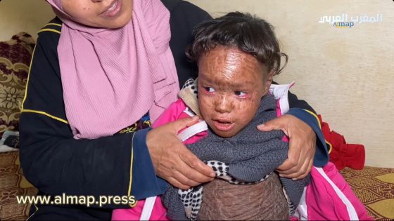 حالة تلخص كل شيئ بفاس..لا سبيطار لا جمعيات ولا مسؤول يقوم بالواجب