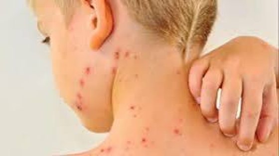 إجراءات وقائية صارمة في المدارس المغربية للحد من الأمراض المعدية