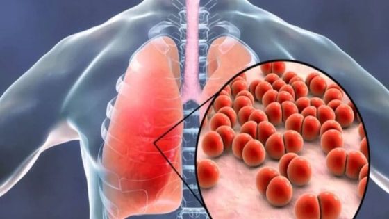 نداء برلماني عاجل بسبب تفشي داء السل في تنغير وسط قلق متزايد من الأهالي