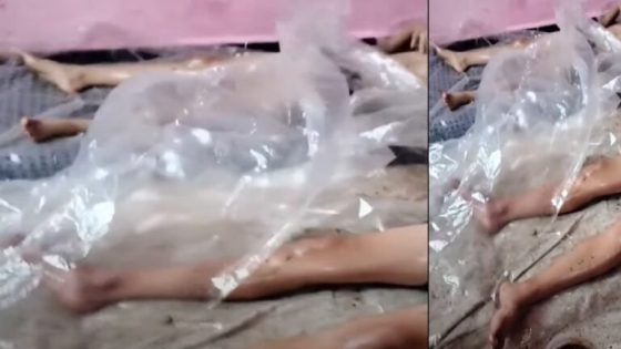 ‎فيديو صادم لعائلة جزائرية تظهر ديداناً تحت جلد أفرادها يثير الرعب ويستدعي تدخلاً صحياً عاجلاً