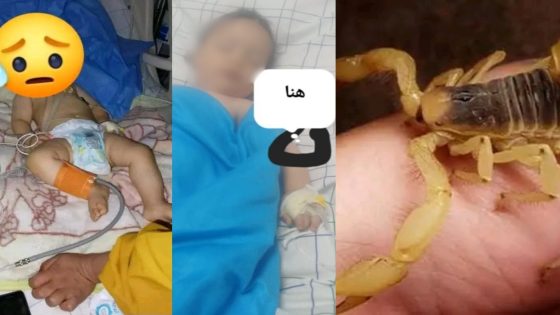 طفل في عامه الأول يتوفى بسبب لدغة عقرب في ورزازات