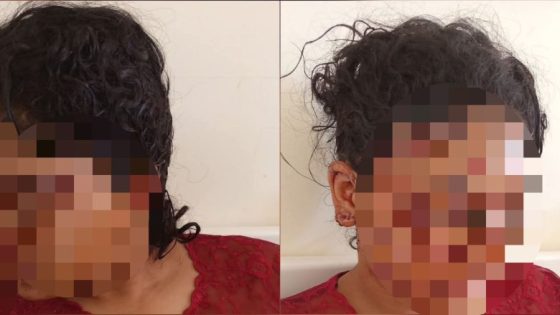 الأميرة لالة مريم تدعم إيمان ضحية الاعتداء بتازة