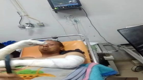 ضاية عوا: انفجار قنينة غاز يهز ساكنة المنطقة… وتدخل صارم لعامل إقليم إفران يضمن الإنقاذ