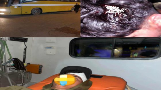 شفشاون: صراع النقل المدرسي ينتهي بدماء