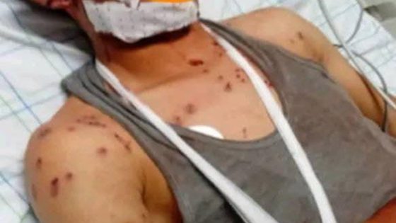 رصاصة طائشة خلال عملية قنص عشوائي تُصيب شاباً بجروح خطيرة بجماعة إغيل نمكون بإقليم تنغير