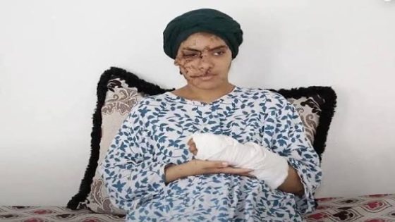 حكم رادع في قضية “إيمان” بتازة… 15 سنة سجناً نافذاً لطليقها بعد اعتداء وحشي خلّف أكثر من 130 غرزة في جسد الضحية