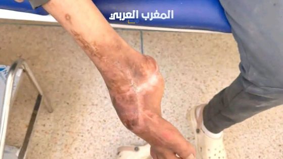 شاب من الداخلة يتسلق لاقطًا هوائيًا احتجاجًا على “الحكرة” بعد إصابته بعاهة مستديمة