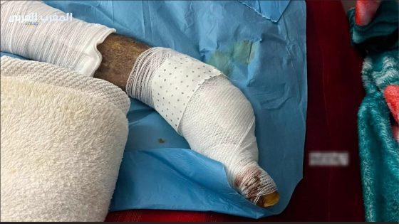 مأساة إنسانية بالمستشفى الإقليمي بالصويرة.. مريض ينتظر العملية منذ 8 أشهر وسط وعود متكررة
